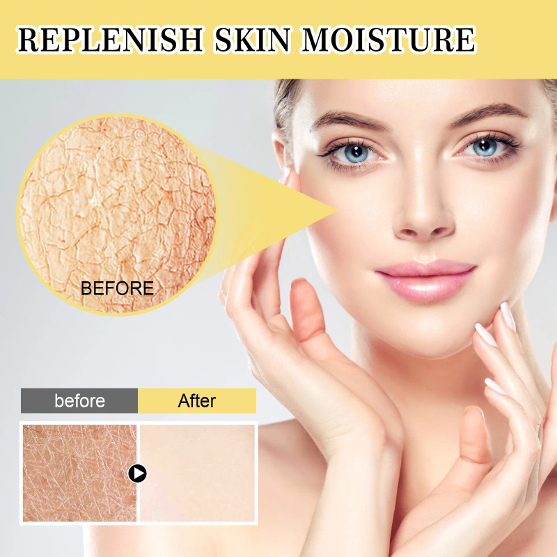 Mucina di lumaca Potere Riparatore Essenza Anti Invecchiamento Siero Viso Macchie scure Trattamento dell'acne Ridurre i pori Nutriente Cura della pelle sensibile_voghion.com