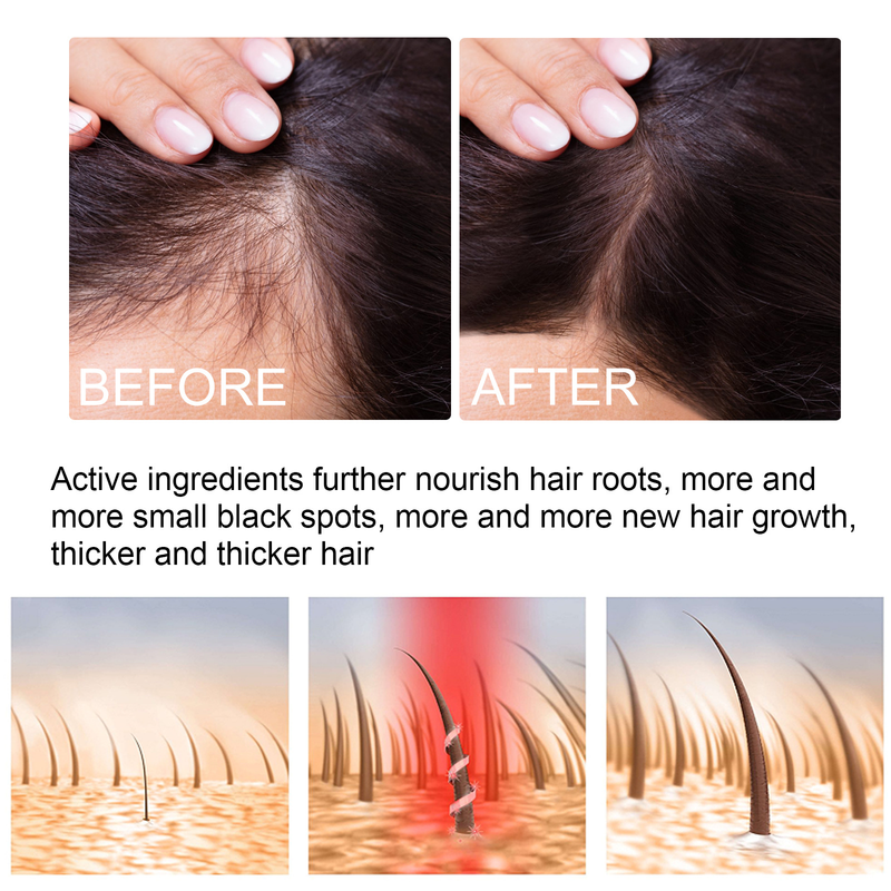 EELHOE Ginger Essential for Repairing Follicles, Smooth Moisturizing Growth, and Nourishing Hair Care Essence Oil_voghion.com