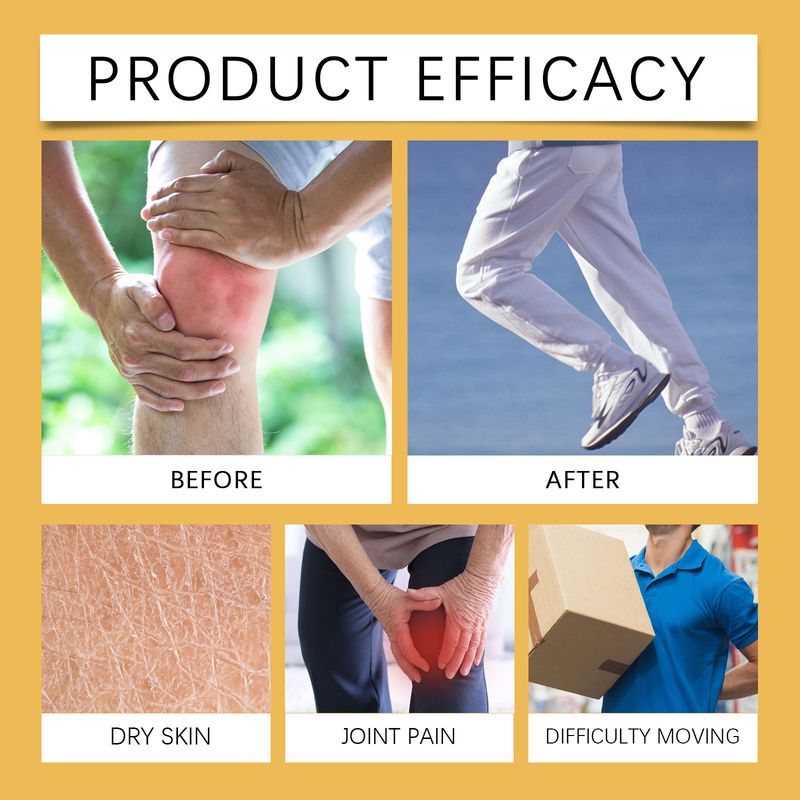 Kurkuma ja inkivääri nivelhoitovoide ulkoiseen käyttöön, rauhoittava nivelkipuvoide, ranteiden ja polvien hieronta_voghion.com