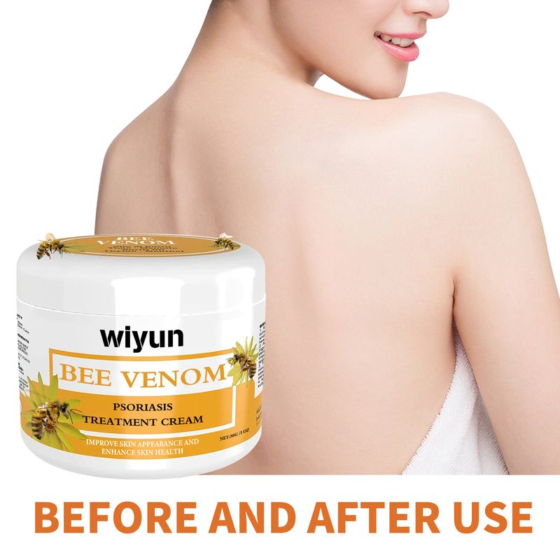 Wiyun Bienengift Hand- und Fußpflege, feuchtigkeitsspendend, angenehme Hautpflege, Creme zur äußerlichen Anwendung_voghion.com