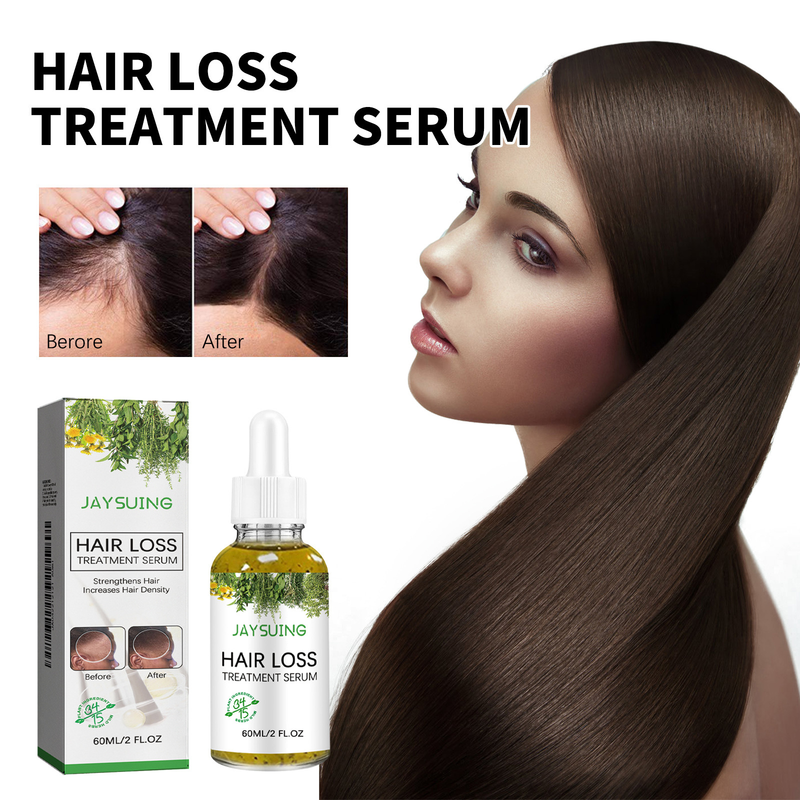 Jayswing essence massaggio cuoio capelluto tonico olio capelli forti_voghion.com
