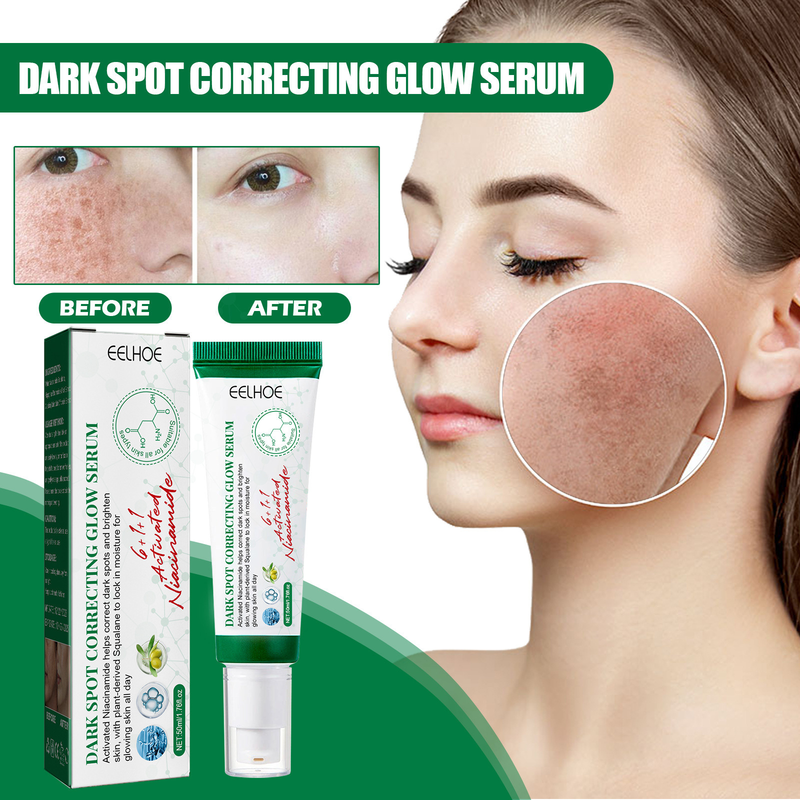 Sérum correcteur de taches sombres, 50ml, blanchissant, imperméable, éclaircissant, éclaircit et apaise_voghion.com