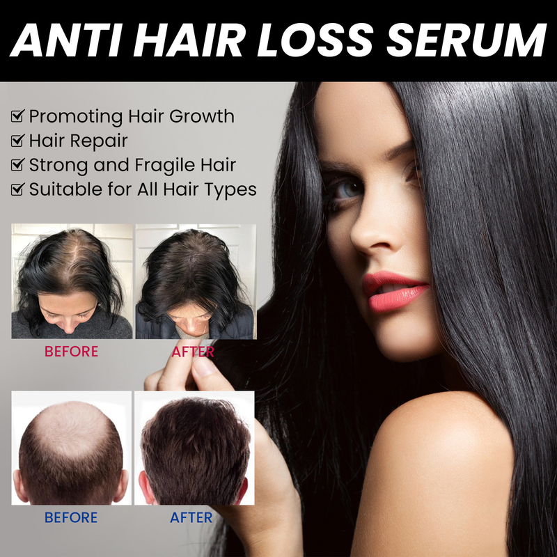 OUHOE anti drop essence, firming, repairing, root thickening, nutrition, tough scalp care, hair essence_voghion.com