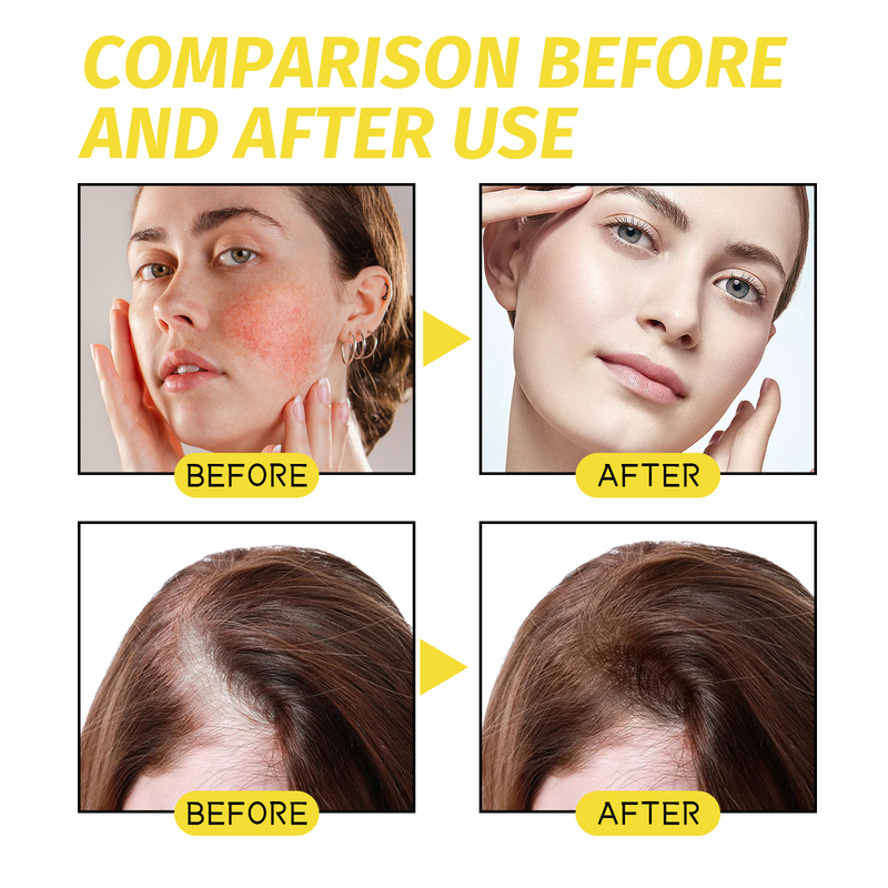 l'olio di semi neri può migliorare la secchezza irritabile, nutrire, riparare i danni, prevenire la caduta dei capelli, capelli densi ed essenziali,_voghion.com