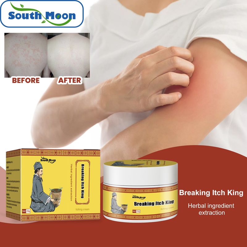 Crema antipruritus para aliviar el enrojecimiento de manos y pies, reparación de musgo, picazón, crema para el cuidado de la piel de South Moon_voghion.com