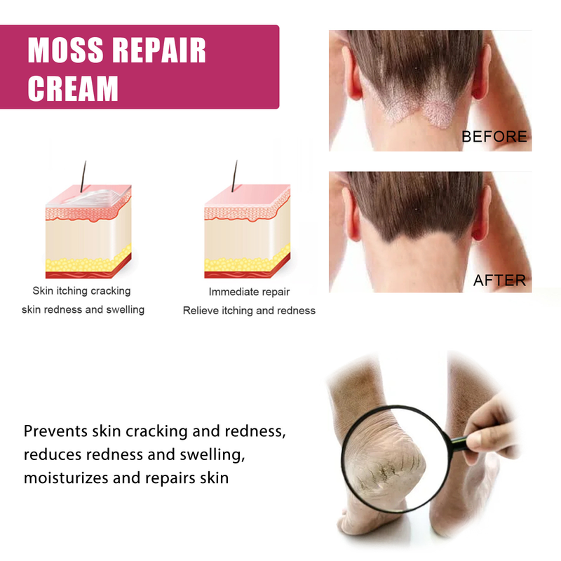 EELHOE Hand and Foot Moisturizing Repair Cream relieves itching, relieves itching, repairs dandruff, moisturizes and moisturizes the skin_voghion.com