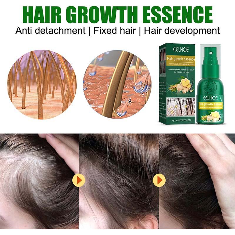 Ingwer-Haarwuchsspray-Produkte, natürliches Anti-Haarausfall-Serum, verhindern Haarausfall, Behandlung, schnelles Wachstum, nähren geschädigtes Haar_voghion.com