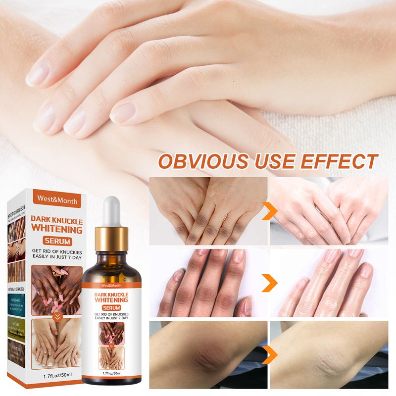 West&Month Skin Blackening Essence, vlažilna esenca za posvetlitev kolen in gležnjev, odstranjevanje melanina iz rogov_voghion.com