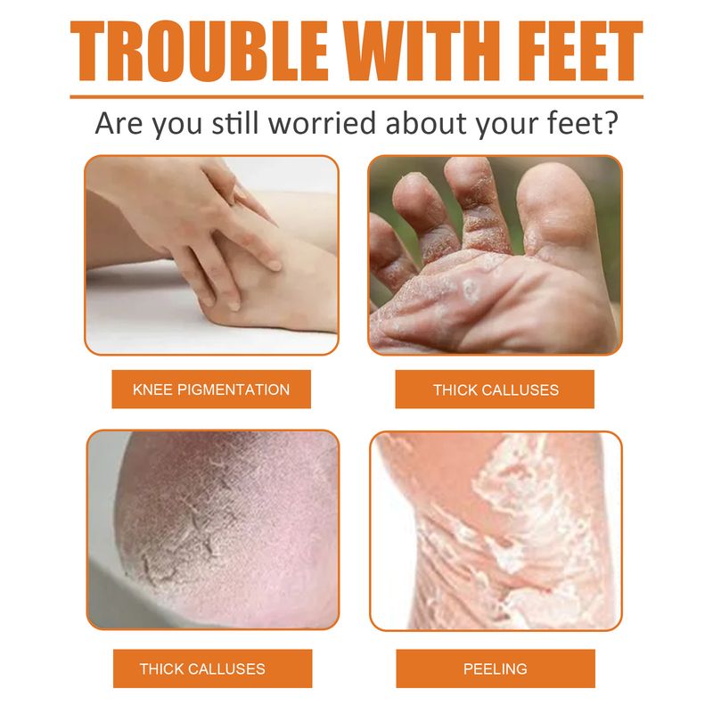 Spray exfoliant pour les pieds pour les peaux mortes, hydratant, nettoyant, réparateur, peau rugueuse et éliminant les callosités 2024 le plus populaire_voghion.com