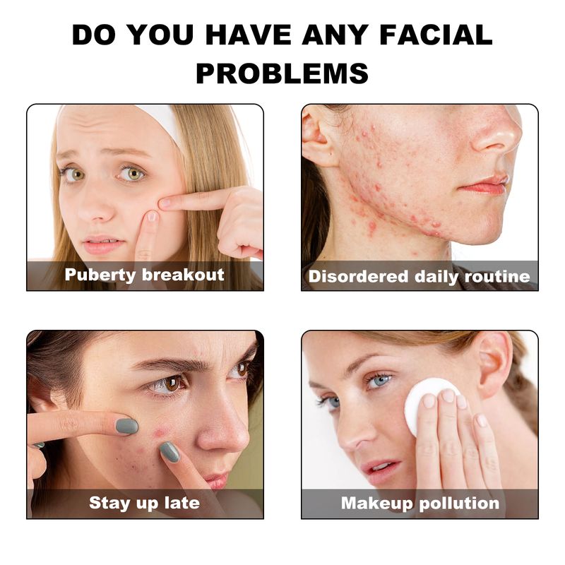 Hoygi Colorful Acne Patch, Repair Acne Closing Mild Non-Irritating Smooth Skin Acne Patch_voghion.com