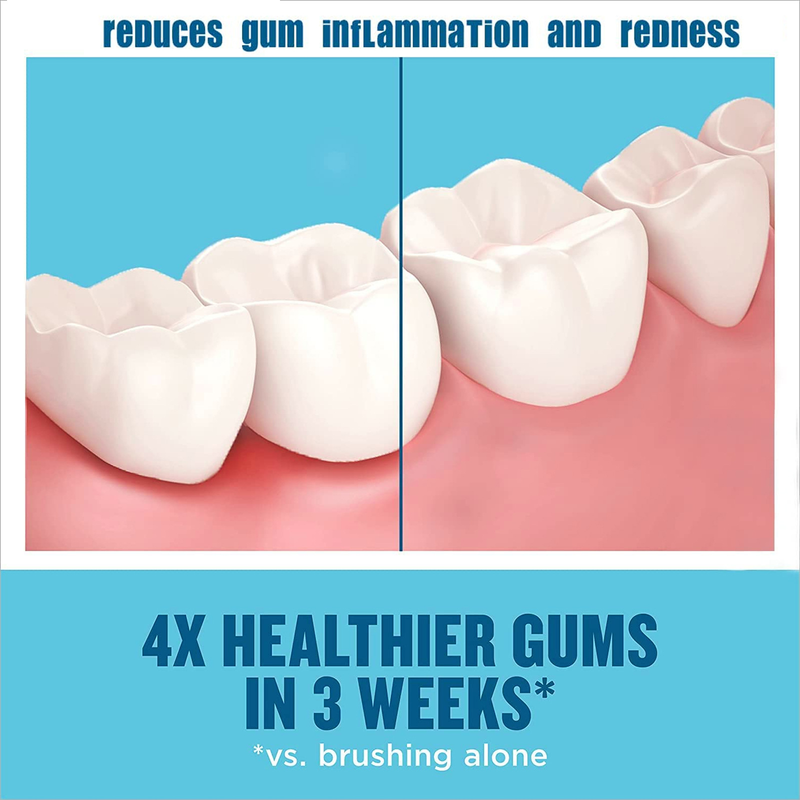 Zahnaufhellung Reinigungsmousse Zähne Entfernen Flecken Anti Hohlraum Bleichen Aufheller Schäumende Zahnpasta Mundhygiene Pflege Weiblich_voghion.com