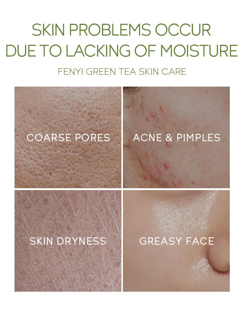 FENYI Grönt te 4 stycken hudvårdsprodukt Resestorlek Prov 1 stycke_voghion.com