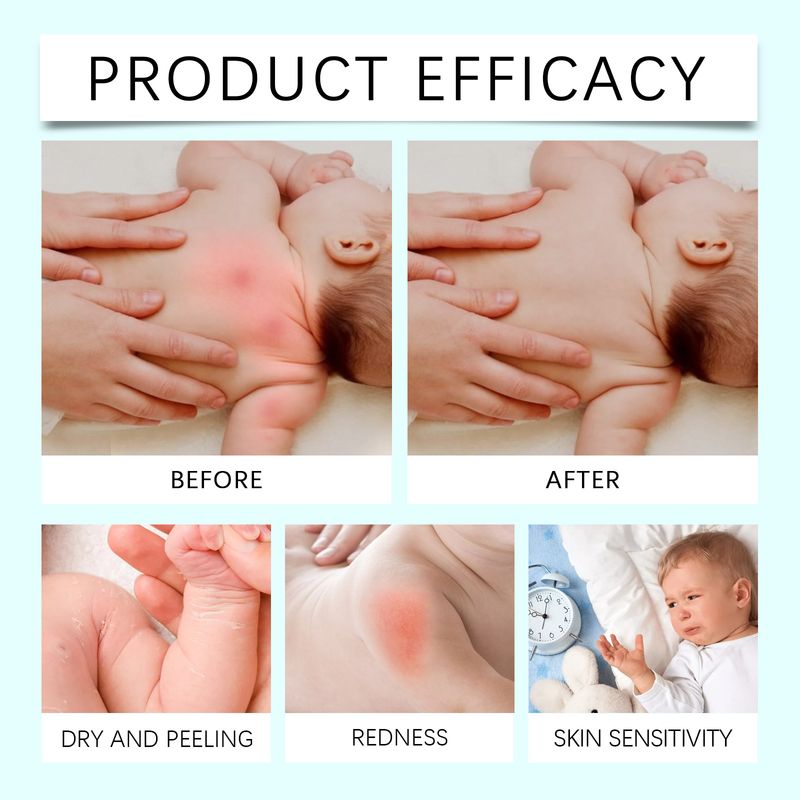 Wiieey Baby Gentle Skin Elasticity Enhancement Hydrating Moisturizing Body Cream_voghion.com