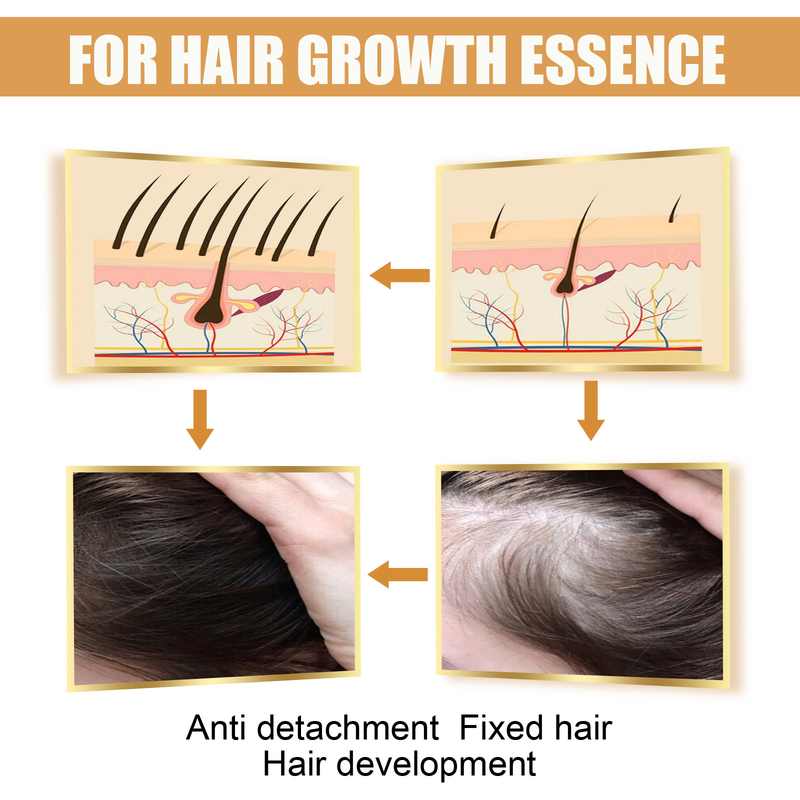 Essence EELHOE MiShui Oil migliora i danni secchi, furiosi e bruciati ai capelli, idrata e ripara i capelli_voghion.com