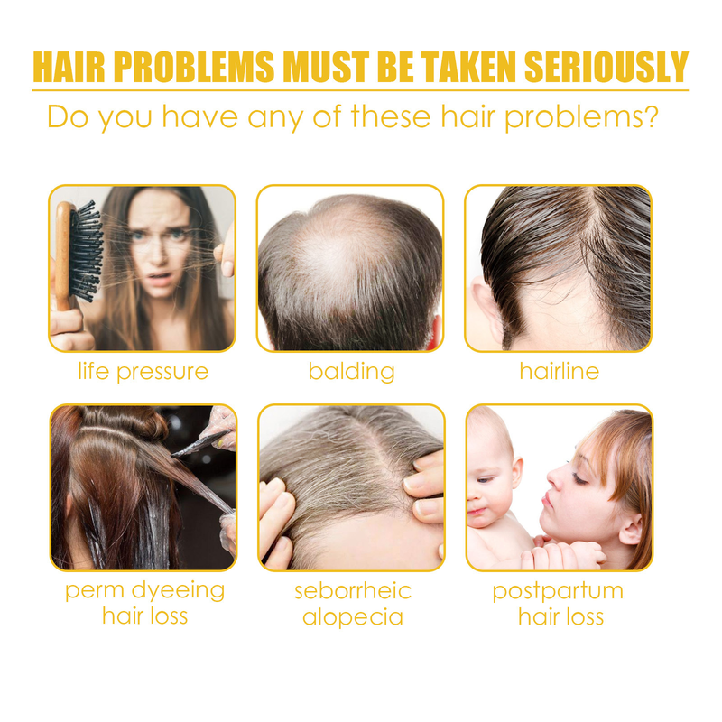 Confezione di shampoo per capelli neri South Moon L'essenza di zenzero idrata i capelli Cura detergente naturale per capelli neri_voghion.com
