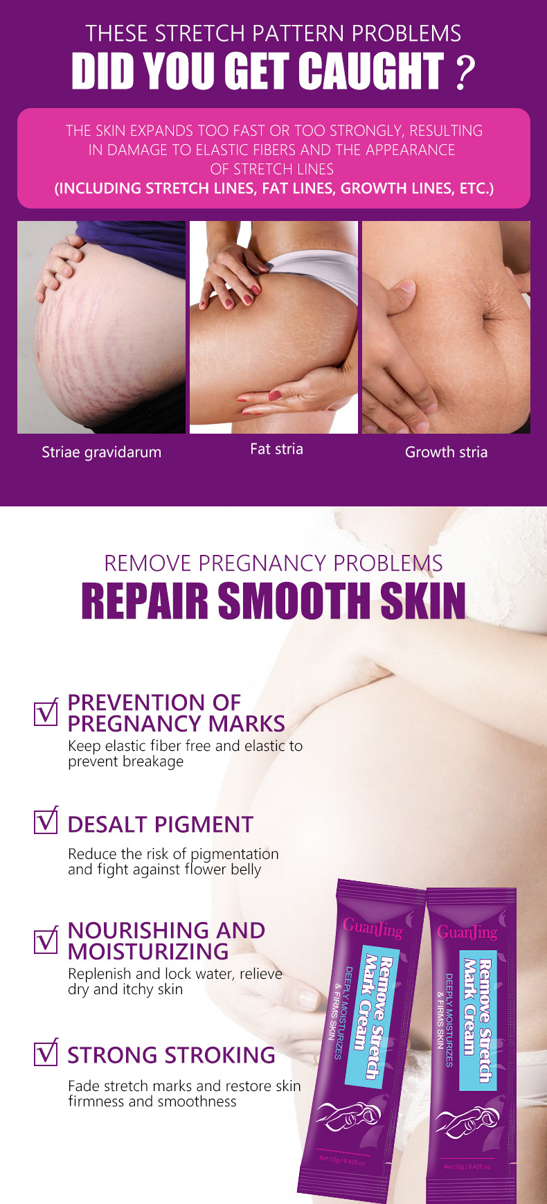 Verwijder striae crème Body Milk Verwijder watermeloen patroon Hydraterende tas Draagbare buikmassage crème Striae vrouwelijk_voghion.com