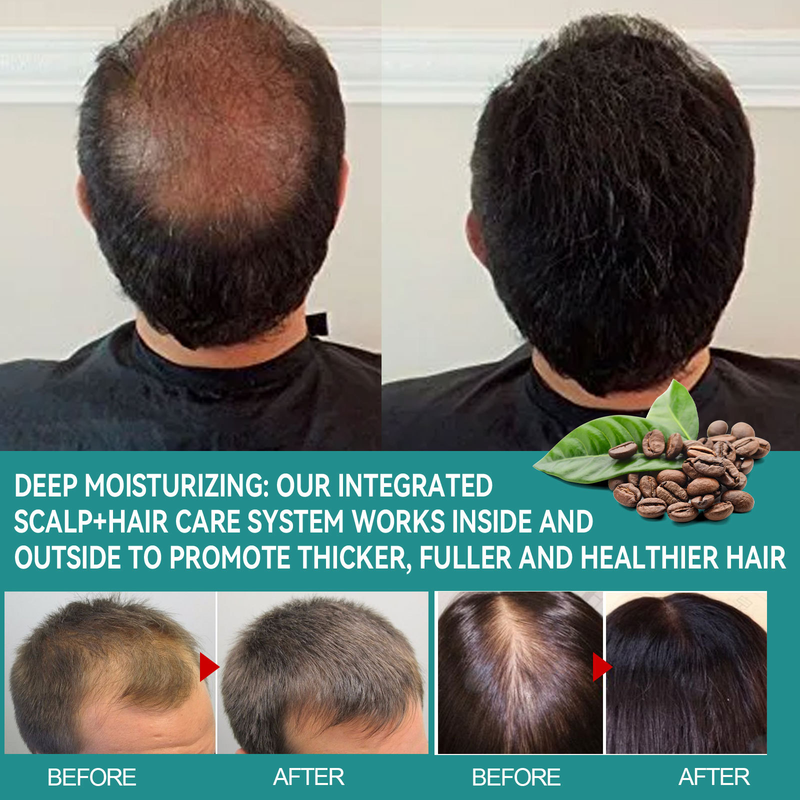 Essenza curativa EELHOE, radice dei capelli forte e nutriente, capelli sodi, essenza riparatrice dell'attaccatura spessa_voghion.com