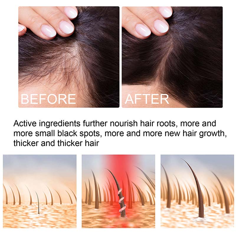 Ingwer-Haarwuchsspray-Produkte, natürliches Anti-Haarausfall-Serum, verhindern Haarausfall, Behandlung, schnelles Wachstum, nähren geschädigtes Haar_voghion.com