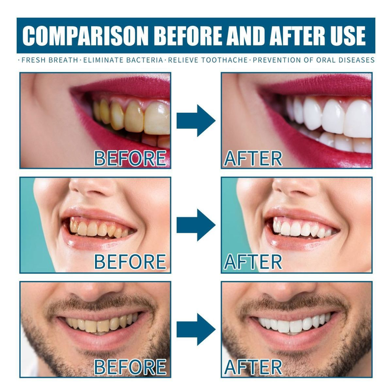 Enxaguante Bucal Jaysuing para Remover Manchas Dentárias, Odores, Limpeza e Cuidados Orais Refrescantes, Manutenção de Cáries novas_voghion.com