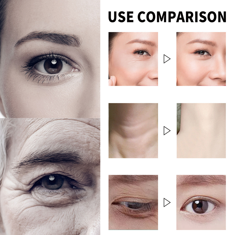 Crema de față Anti Beautiful cu retinol anti-îmbătrânire poate reduce liniile fine din jurul ochilor, strânge ridurile și ridica..._voghion.com