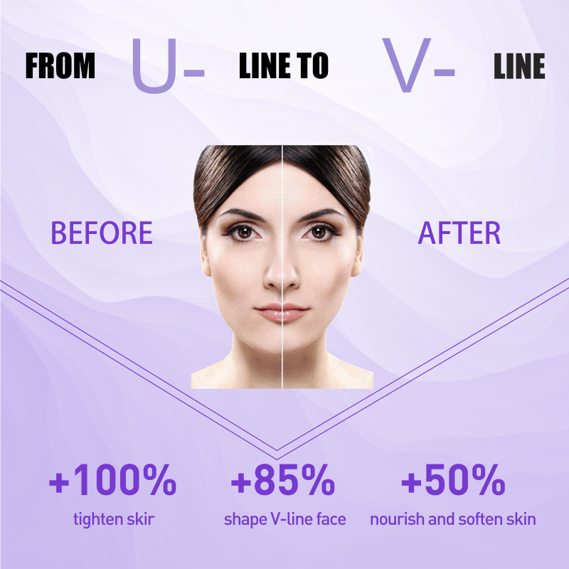 Creme Ansigtsløftning Slankende Tynd V Ansigtsløftning Opstrammende Fjernelse Masseter Muscle Dobbelthage Anti-aging Fugtgivende Skønhed_voghion.com