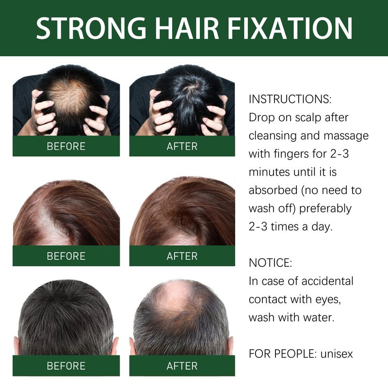 Essenza per capelli densa e rinforzante allo zenzero per la crescita dei capelli_voghion.com