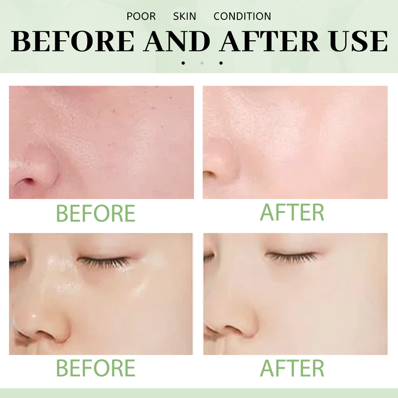 EELHOE Grüner Tee Feste Gesichtsmaske_voghion.com