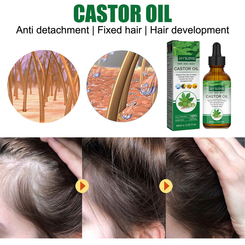 previene la perdita dei capelli Jaysuing, idrata, ripara le linee sottili e spesse, rinforza e solidifica l'essenza dei capelli_voghion.com