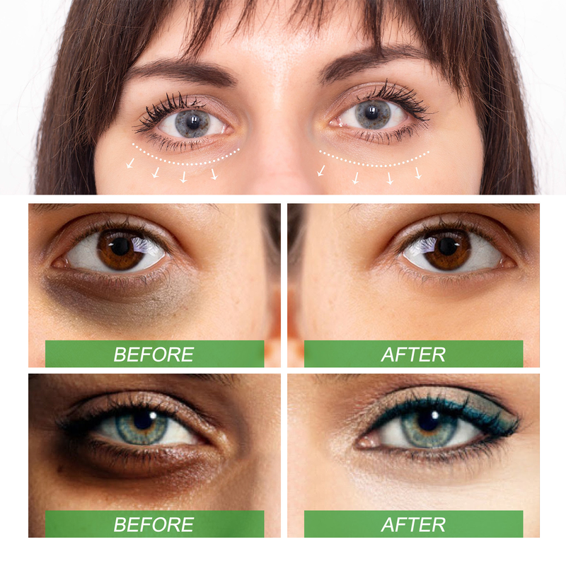 Ορός κατά των μαύρων κύκλων Διόρθωση χρωστικών ουσιών Αφαίρεση πρηξίματος Σακούλα ματιών Ενυδάτωση Ενυδάτωση Θρέψη Αλόη βέρα Λευκαντικό άρωμα ματιών_voghion.com