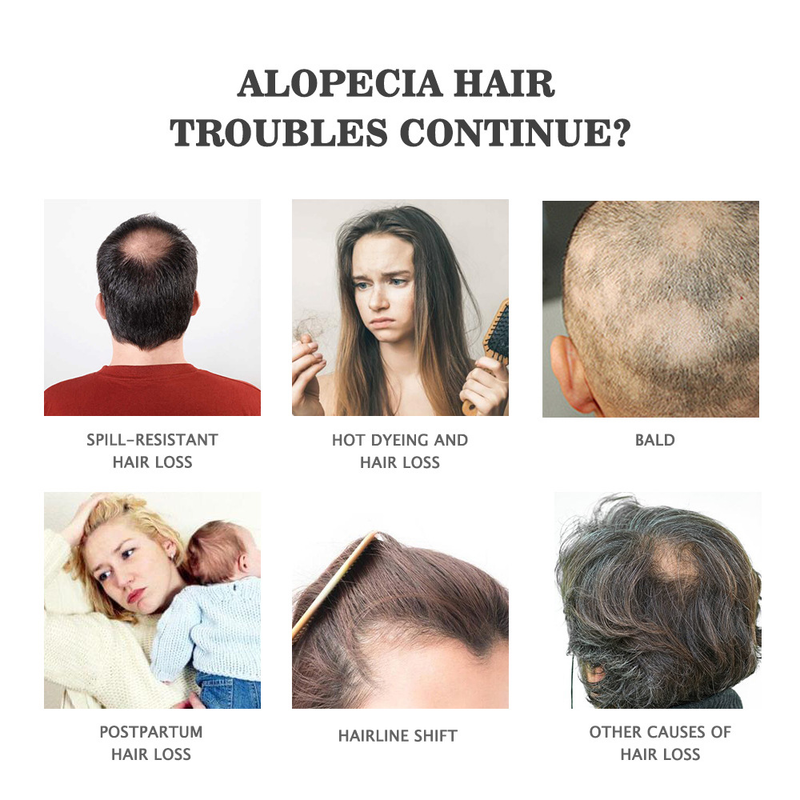 Hair Care Essential Oil Anti Split Plant Extract For Repairing Restlessness 30ml_voghion.com