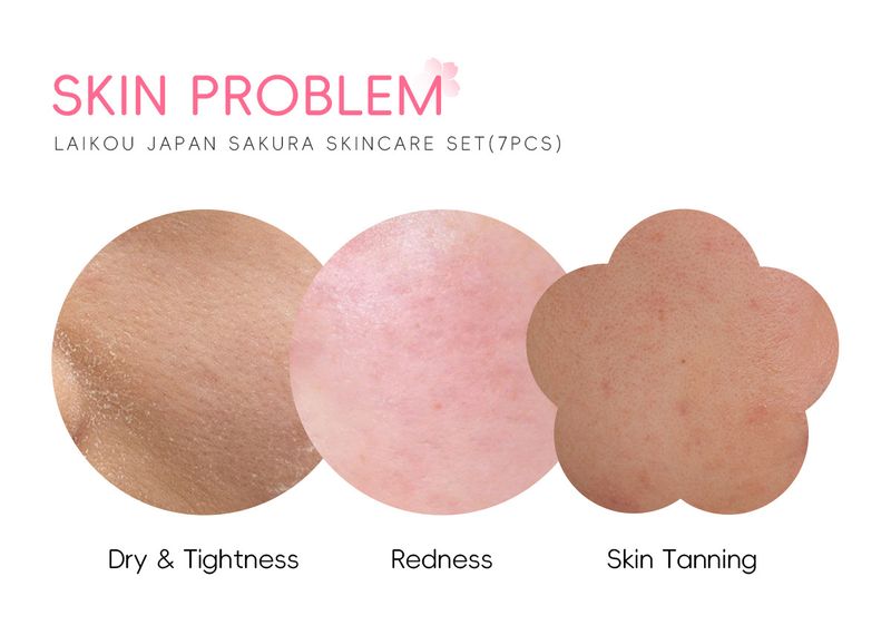 Κιτ περιποίησης προσώπου με μάσκα λάσπης 7 τεμαχίων για καθαρισμό δέρματος Laico Japanese Sakura_voghion.com