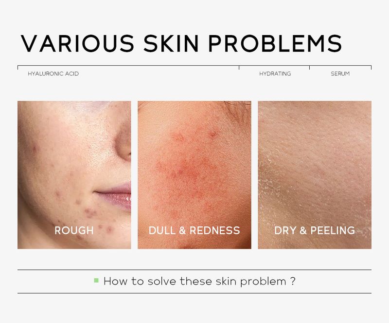 Serum QUIYUM Hyaluronic Acid Essence Hyaluronic Acid Spray Hydrating Repair Stock Solution 30ml_voghion.com