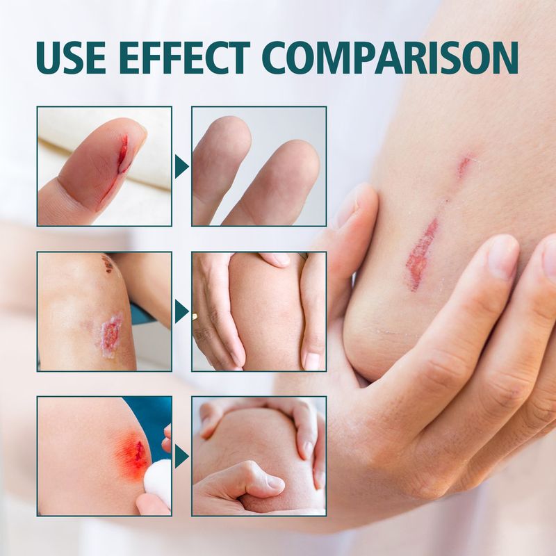 Ximonth Repair Relieving Scratches And Traumas, Fading Scars, Moisturizing Skin Care Cream_voghion.com