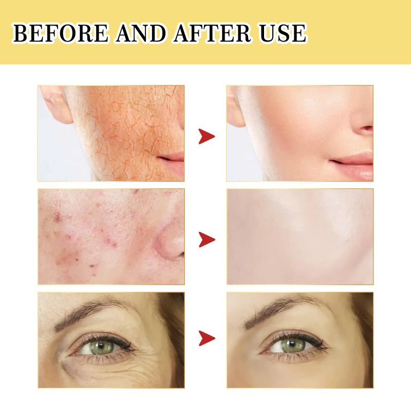 Mucina di lumaca Potere Riparatore Essenza Anti Invecchiamento Siero Viso Macchie scure Trattamento dell'acne Ridurre i pori Nutriente Cura della pelle sensibile_voghion.com