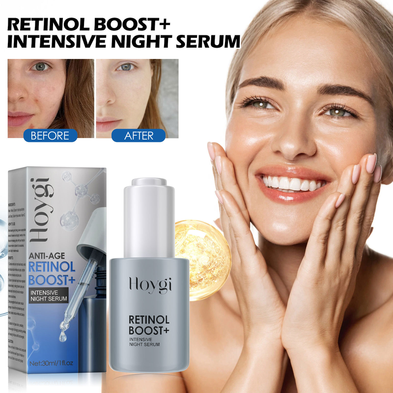 Hoygi Retinol-ældning Fugtgivende, opstrammende, anti-aging, lysende plet og fine linjer essens_voghion.com