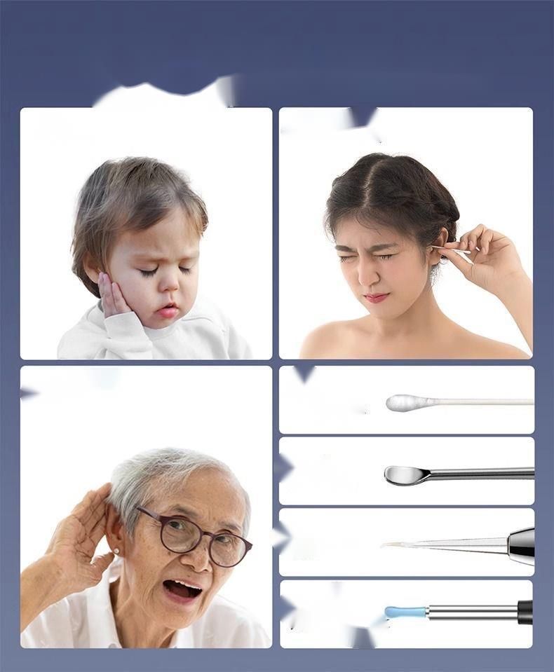 High-Definition-Pick-Reinigung für Kinder Ohrclip Wireless Visual Pinzette Professionelles Werkzeug_voghion.com