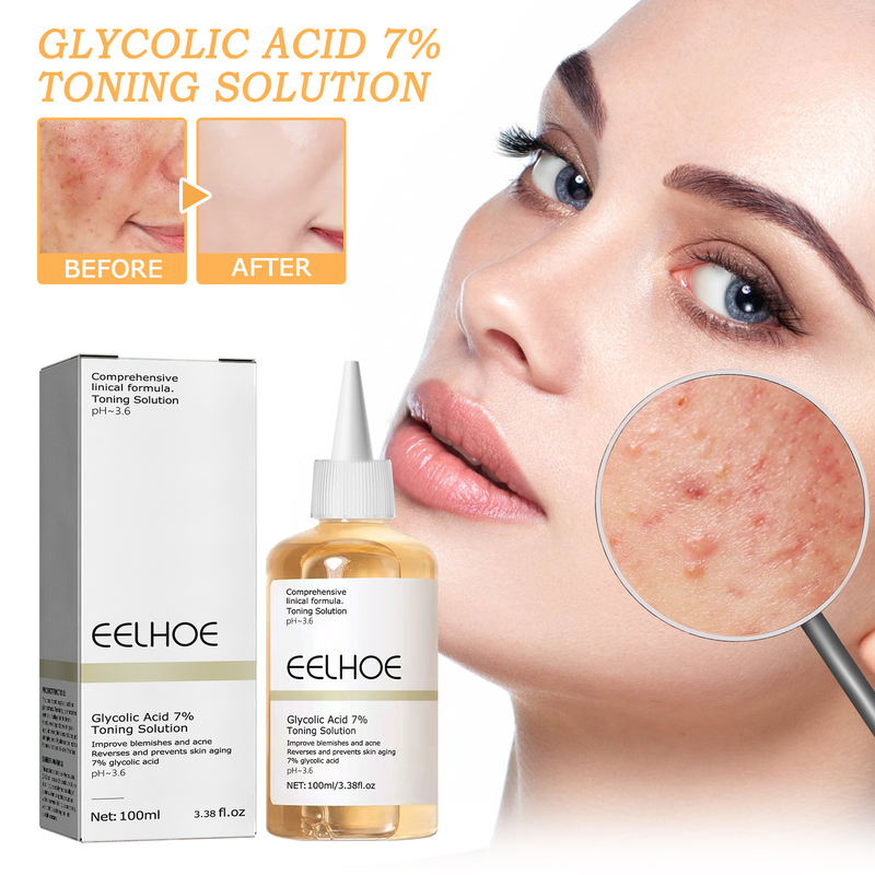 EELHOE Glycolic Acid 7% Toner Removal, Fading Acne Marks, Removing Closed Acne, Repairing Skin Moisturizing and_voghion.com