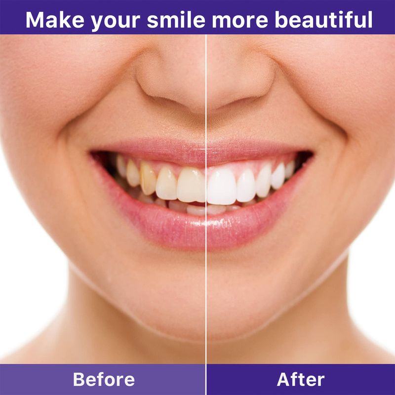 V34 Cleaning Stains and Caring Gingivals Whitening Tooth Oral Care Toothpaste 2024 best_voghion.com
