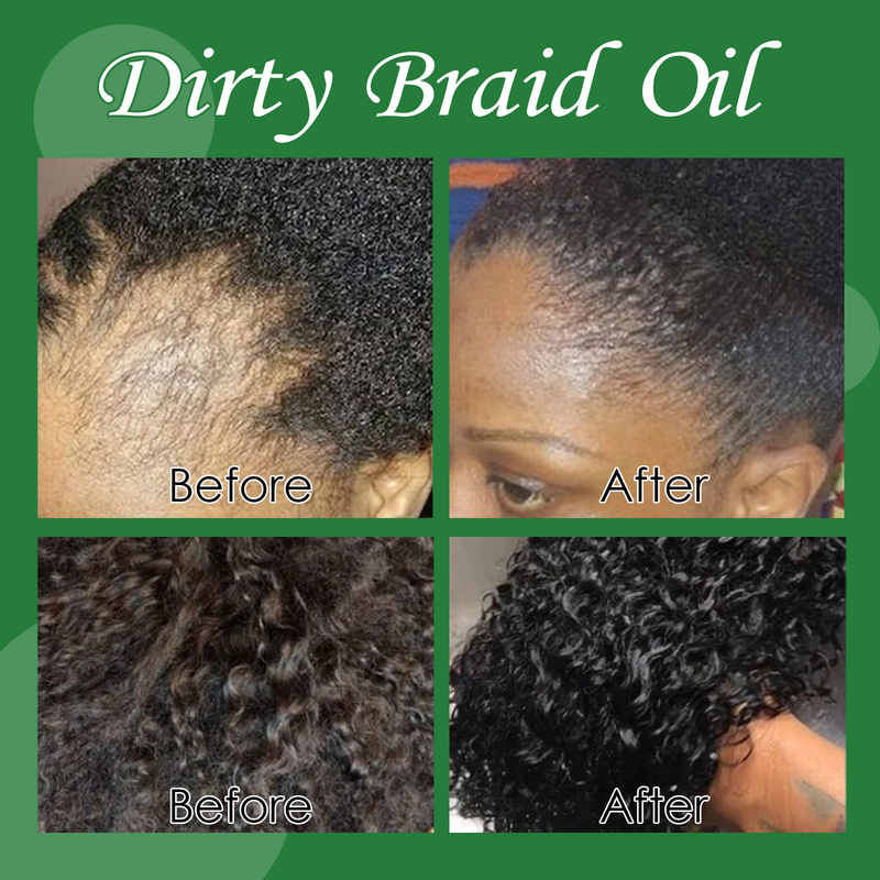 Dense EELHOE Braid Hair Oil Deterge il cuoio capelluto, ammorbidisce i capelli, nutre previene la caduta, rinforza e ripara i capelli_voghion.com