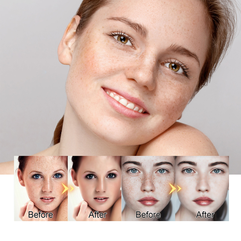Cream Beautiful Freckle Moisturizes and Moisturizes Freckles, Blackspots, Yellowish Brown Spots, and Melanin Whitening s,_voghion.com