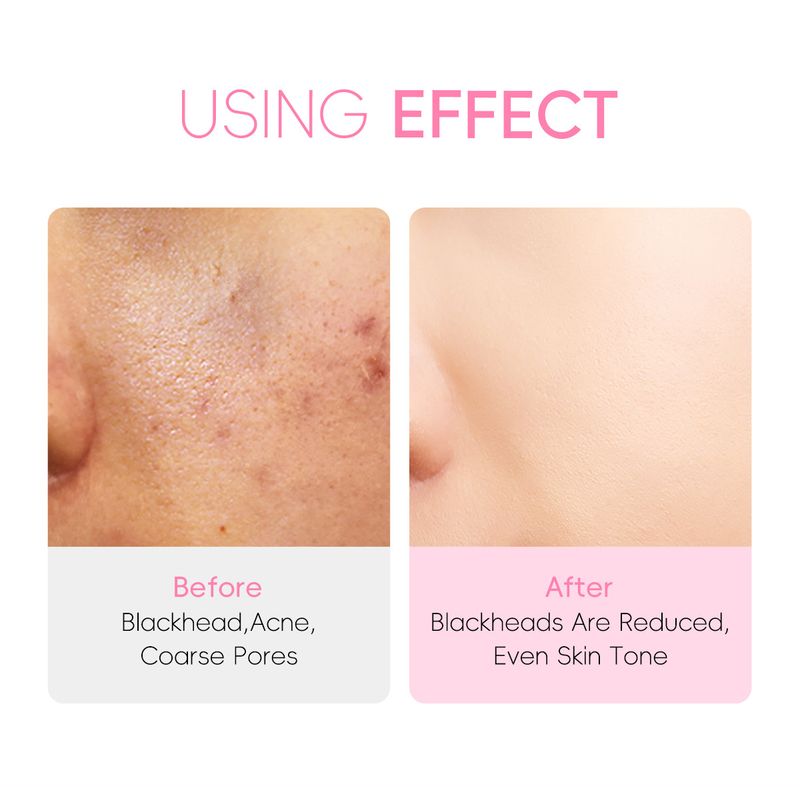 Treatments & Masks Sakura Mud Mask Box 5g*20 Hydrating Moisturizing Sleeping Mask Skin Care Products_voghion.com