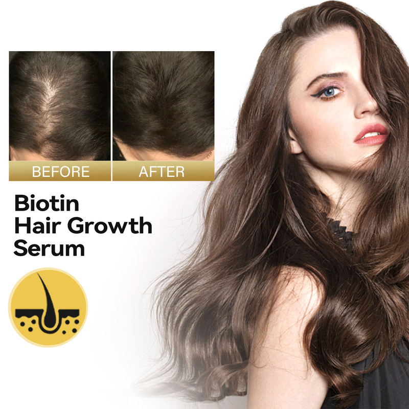OUHOE Biotină Anti-cădere, Reparare fixă, Hidratare rădăcină, Esență de balsam de păr dens_voghion.com