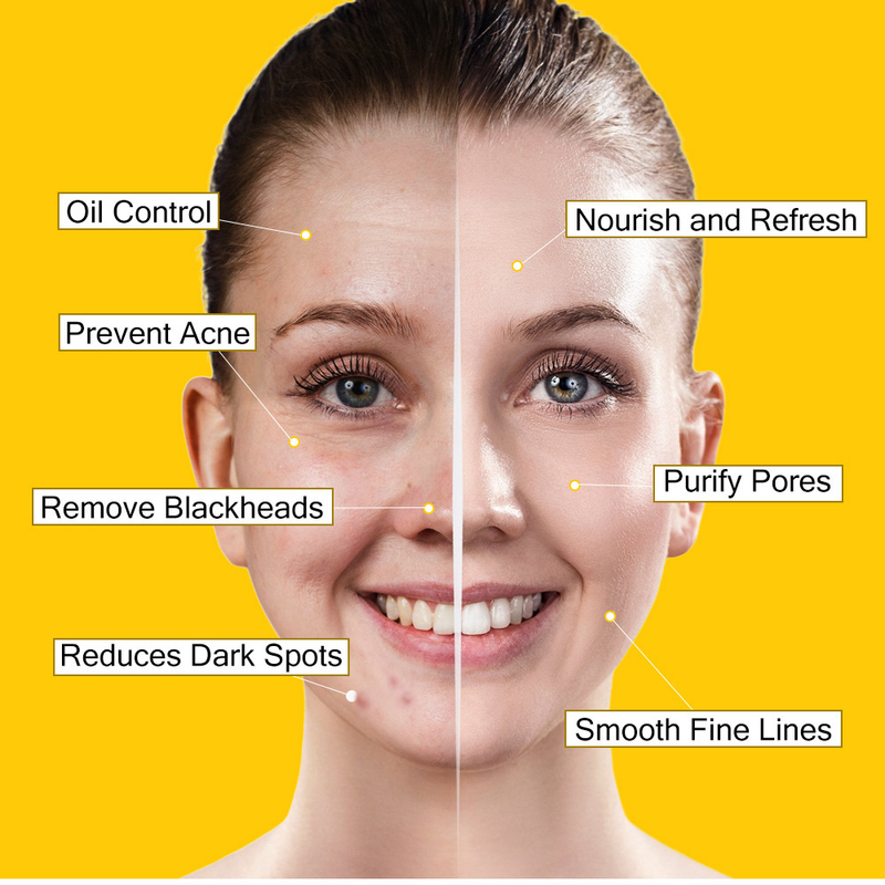 Máscara de limpeza de lama removedora de cravos e iluminadora extrato de cúrcuma máscara facial hidratante_voghion.com