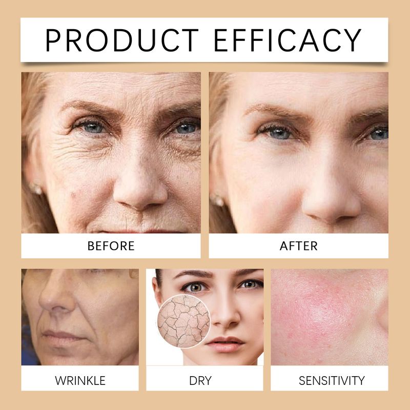 Hoygi Retinol Moisturizing Cream Mildly Moisturizes, Tightens, Softens, Moisturizes And Protects Skin Face Cream_voghion.com