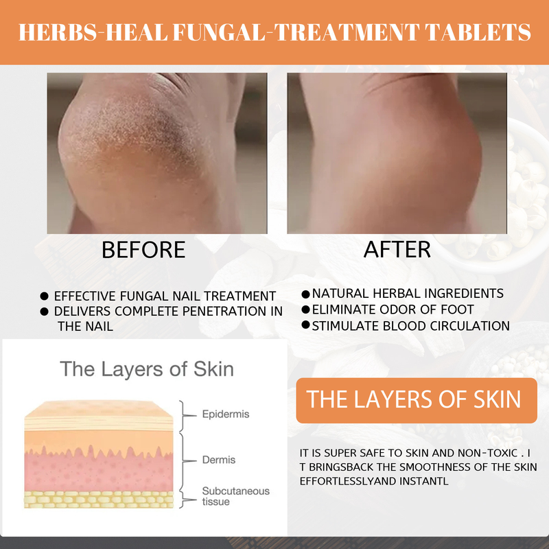 Bagno Bellissimo Piede Compresse per Piedi ammollo Vecchio Zenzero Compresse per piedi ammollo per dissipare il freddo e rimuovere l'umidità, Unghie grigie_voghion.com