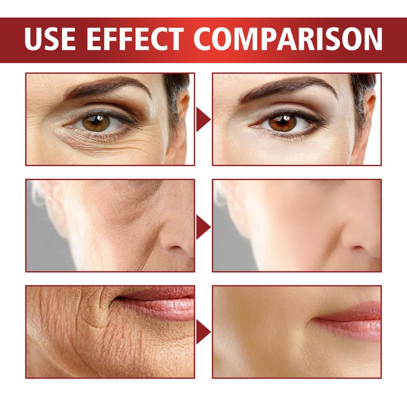 Hoygi Retinol Firming face cream Lightens Fine Lines Wrinkles on Face, Firms the Skin, wrinkle and Anti aging_voghion.com