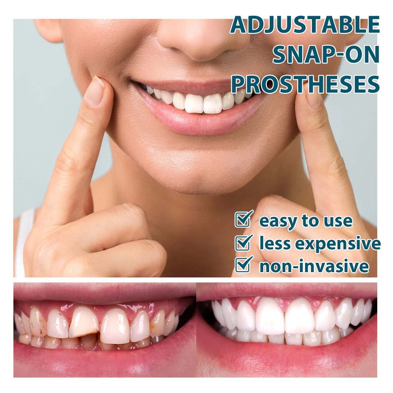 2024 juego temporal ajustable a presión más popular para dentaduras postizas, relleno de huecos y juego de dientes correctores_voghion.com