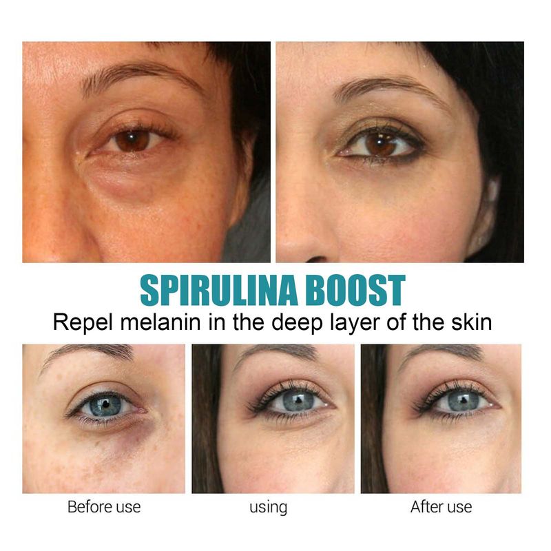 Retinol Anti-wrinkle Eye Cream Dark Circles Eye Bags Remove Anti-puffiness Fade Fine Lines Moisturizing Eye Care Original 2024_voghion.com