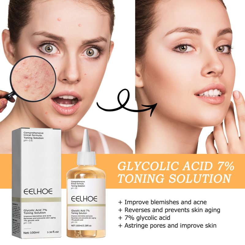 EELHOE Glycolic Acid 7% Toner Removal, Fading Acne Marks, Removing Closed Acne, Repairing Skin Moisturizing and_voghion.com