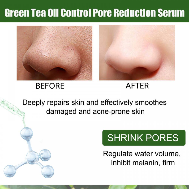 Serum za obnovu lica sa zelenim čajem, umirujući serum za kontrolu masnoće, serum za skupljanje pora, izbjeljivanje lica, uklanjanje tamnih mrlja, akni i mitesera, njega kože_voghion.com